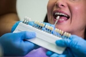 Read more about the article Everything You Need to Know About Surgical Tooth Extraction