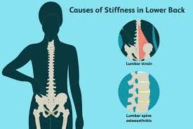 Read more about the article Managing a Stiff Lower Back with Aspadol Tablet: A Simple Guide