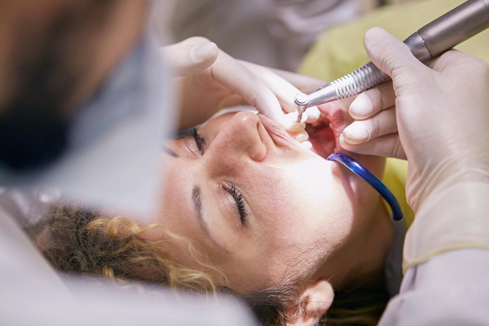 Read more about the article Root Canal Treatment in Jaipur – Save Your Natural Smile