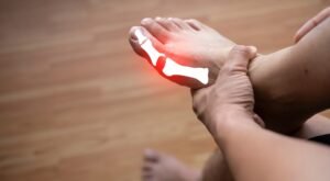 Read more about the article What Are the Top 7 Medications Commonly Used in Gout Treatment