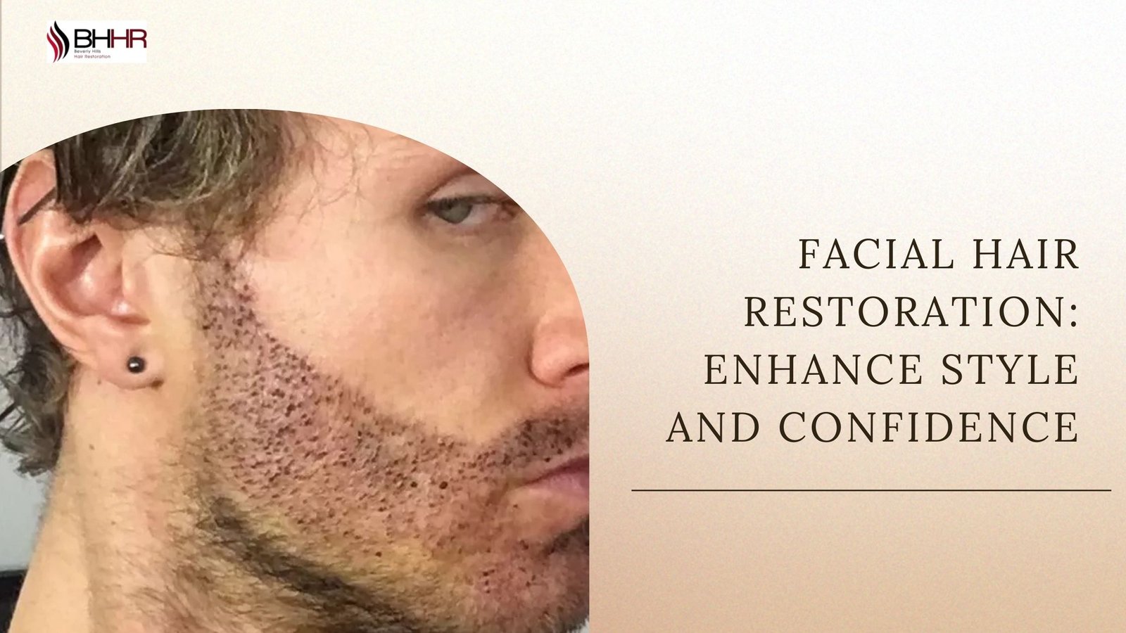 You are currently viewing Facial Hair Restoration: Enhance Style and Confidence
