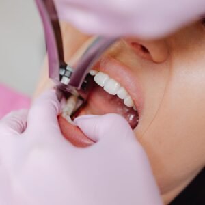 Read more about the article Gum Care : 5 Expert Tips for Prevention of Gum Disease