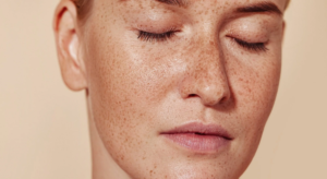 Read more about the article How Does Pigmentation Treatment Improve Skin Tone?
