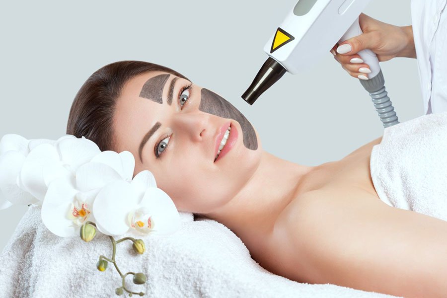 You are currently viewing How Laser Carbon Peel Helps in Reducing Pores?