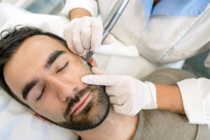 Read more about the article Is Beard Laser Hair Removal the Right Choice for You?