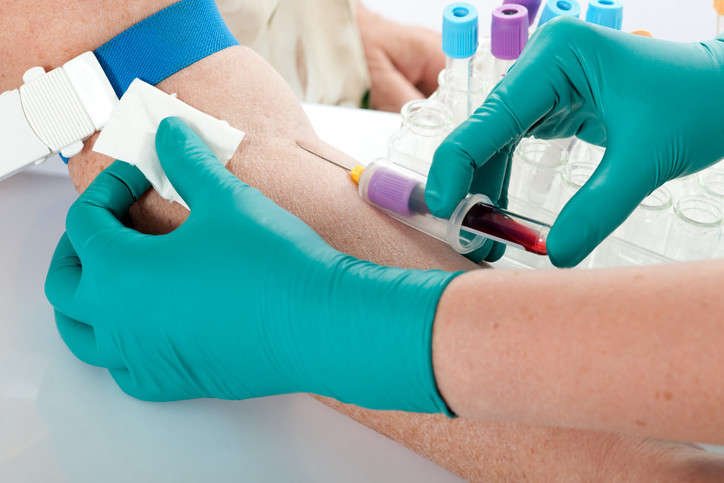 Read more about the article Is a Blood Test at Home Confidential and Secure?