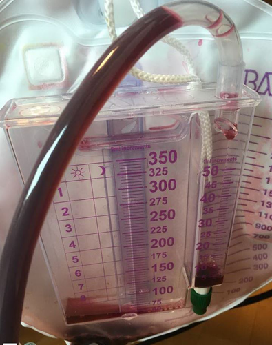 You are currently viewing The Impact of Chromaturia on Your Health