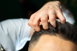 Read more about the article How to Identify the Best Hair Transplant Specialists