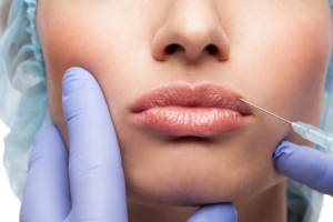Read more about the article Russian Lip Fillers: The Secret to Perfectly Sculpted Lips