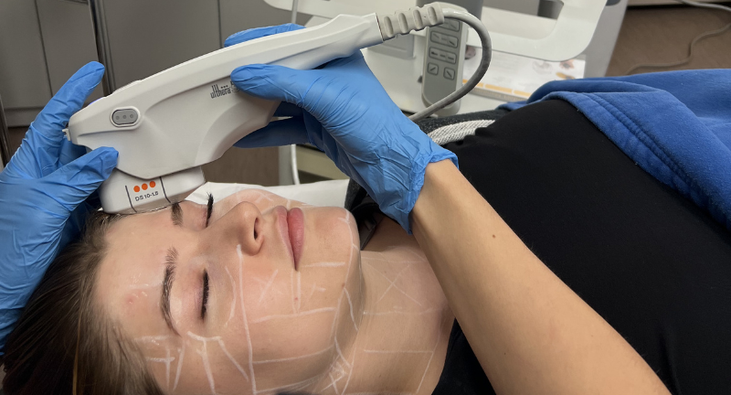 Read more about the article What Makes Ultherapy Popular for Non-Invasive Lifting?