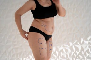 Read more about the article What to Wear After Liposuction: Compression Garment Guide