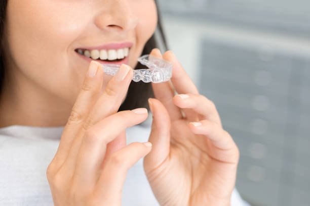 Read more about the article Can Clear Aligners Straighten Teeth Faster Than Braces?