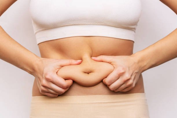 Read more about the article How Circumferential Abdominoplasty Helps With Skin Laxity ?