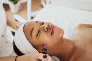 Read more about the article How Microneedling for Acne Scars Boosts Skin Smoothness ?