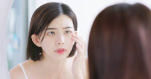 Read more about the article Is Dark Circles Treatment the Answer to Sleepless Eyes?