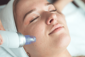 Read more about the article Is RF Microneedling Painful or Comfortable