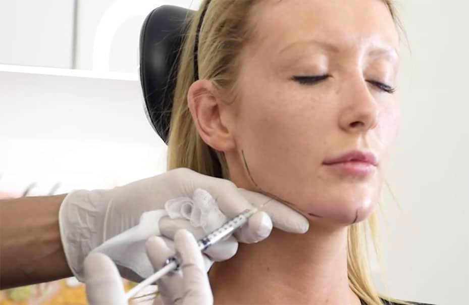 Read more about the article Why Jawline Fillers Are Popular