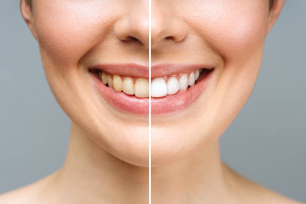 You are currently viewing Restorative Dentistry vs. Cosmetic Dental Care: What is the difference?