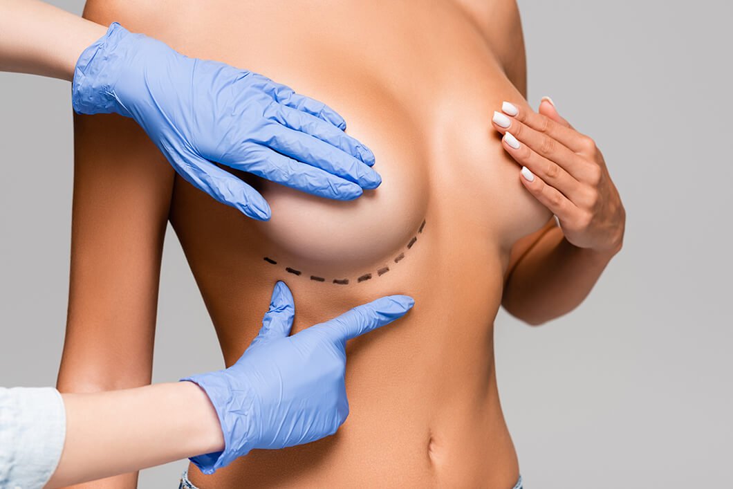 You are currently viewing Is Next-Level Beauty Within Reach with Breast Augmentation in Dubai?