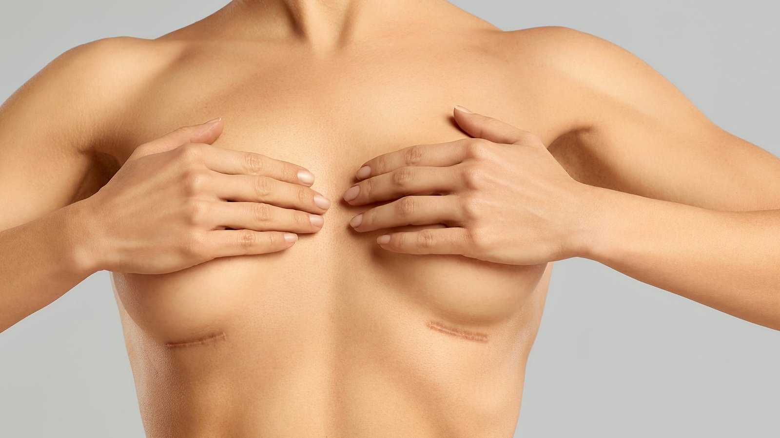 You are currently viewing Breast Augmentation Surgery Designed for Lasting Beauty