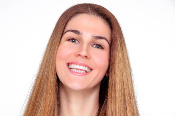 Read more about the article Can E-Max Veneers Restore Chipped Teeth?