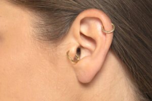 Read more about the article Can Ear Piercing Reduce Scarring Risks?
