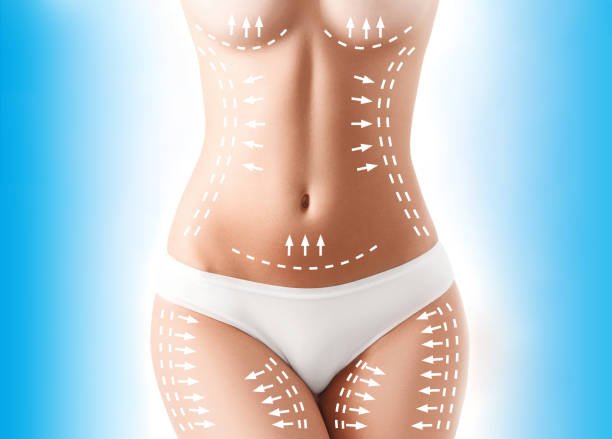 You are currently viewing Can Liposuction Enhance Natural Body Proportions?