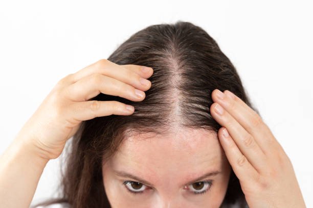 You are currently viewing Can Targeted Therapies Restore Hair Loss & Nail Disorders ?
