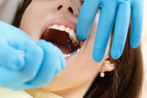 Read more about the article Can Tooth Removal Prevent Tooth Alignment Problems?