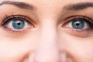 Read more about the article Does Eye Bag Removal Help Improve Self-Confidence?
