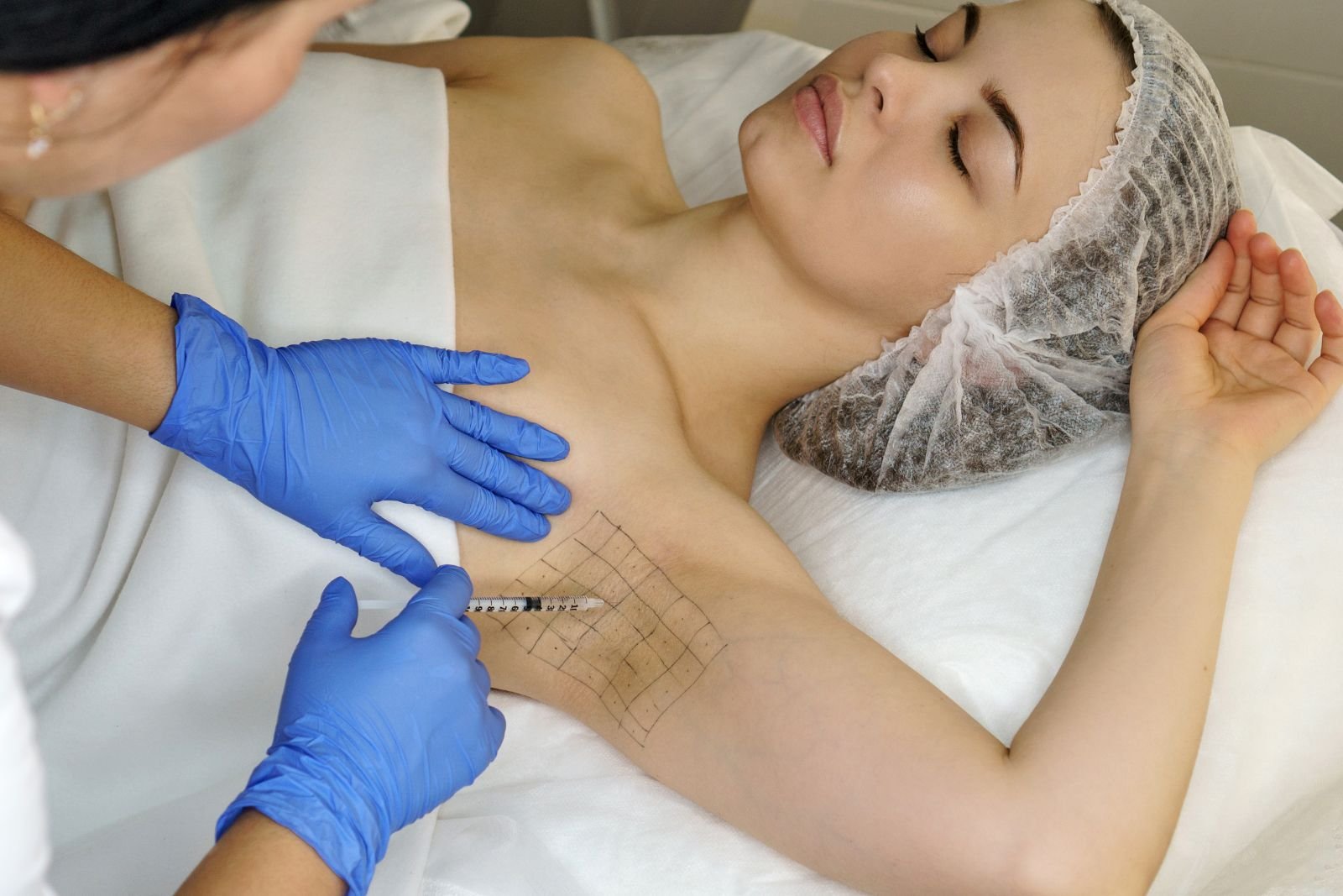Read more about the article Dose Botox for Sweaty Glands Require Downtime