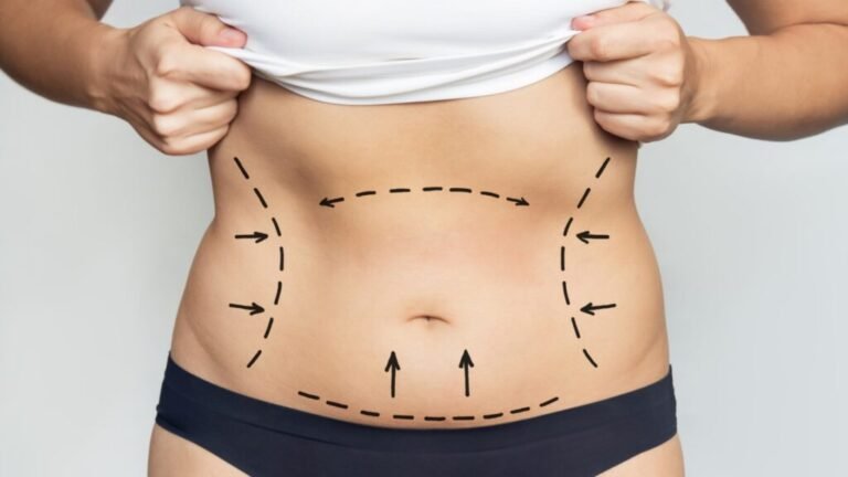 You are currently viewing Enhance Your Body Contours with Laser Liposuction