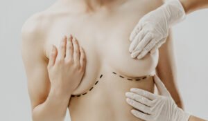 Read more about the article Can Breast Augmentation Help You Achieve Flawless, Curvaceous Contours and Silhouette