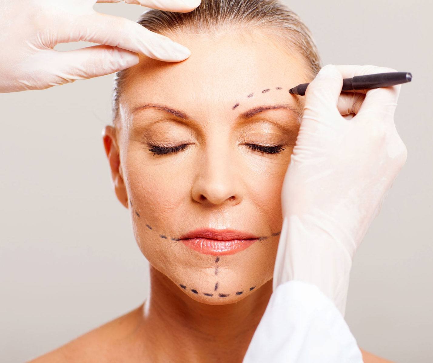 Read more about the article Facelifts From Consultation to Recovery