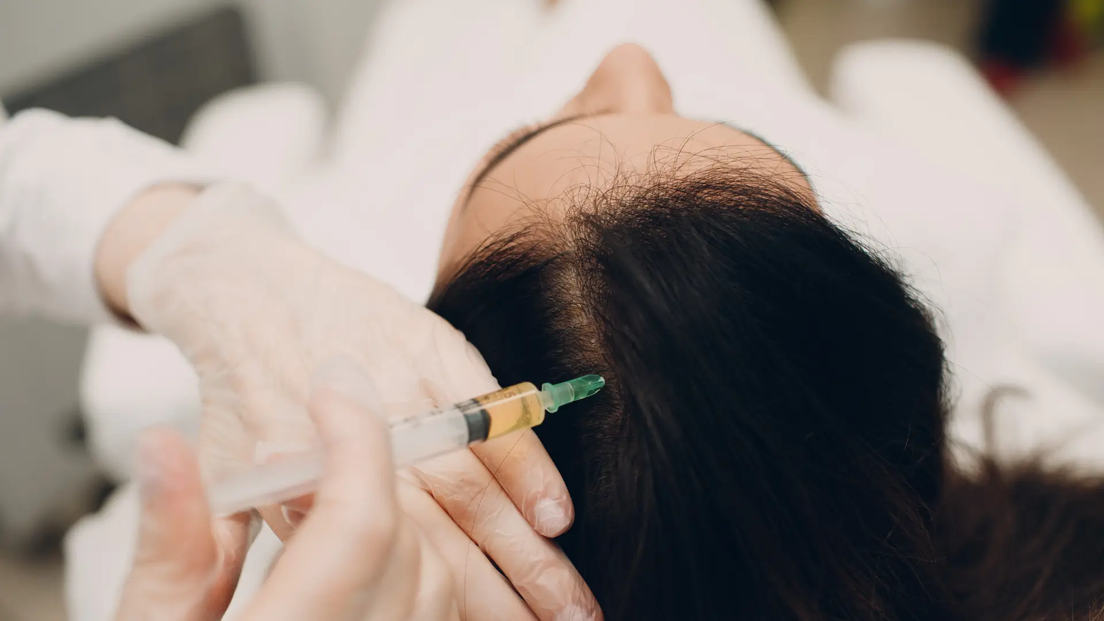 You are currently viewing Hair Fillers Techniques You Need to Know