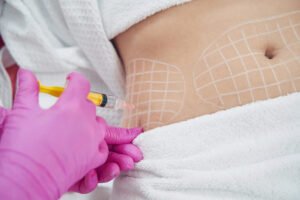 Read more about the article How Long Do Fat Melting Injections Results Last