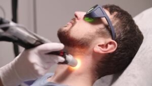 Read more about the article How Long Do Results Last with Beard Laser Hair Removal ?