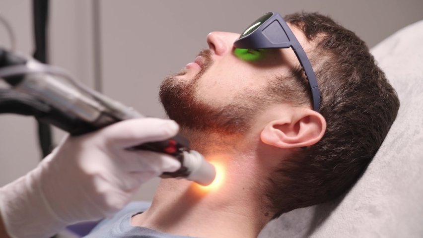 You are currently viewing How Long Do Results Last with Beard Laser Hair Removal ?