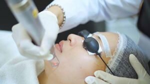 Read more about the article How Many Sessions Pico Laser Treatment Needs