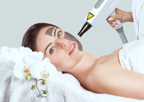 You are currently viewing How Should You Prepare for a Laser Carbon Peel Session?