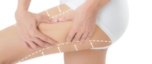 Read more about the article How to Choose the Right Surgeon for a Thigh Lift