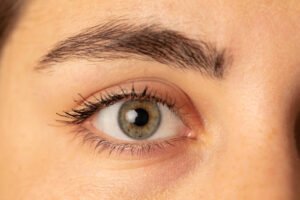 Read more about the article Is Blepharoplasty Suitable for Aging-Related Eyelid Issues?