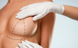 Read more about the article Is Breast Augmentation Surgery Popular Worldwide?