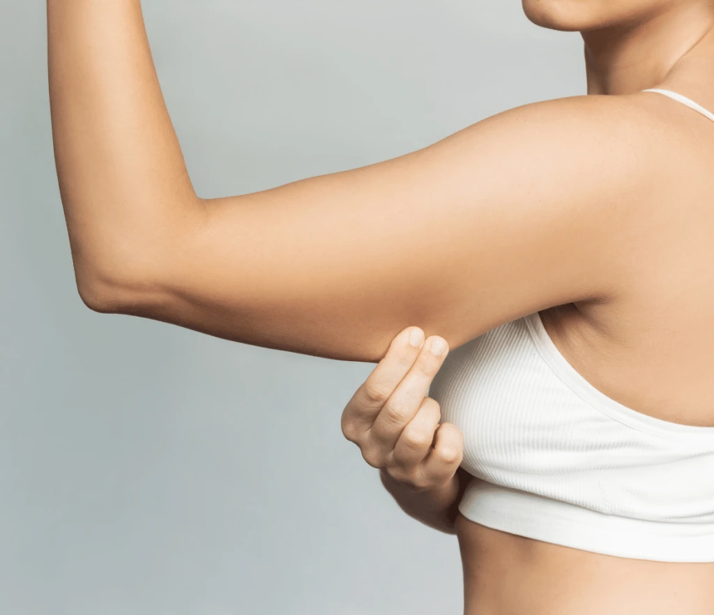 You are currently viewing Is an Arm Lift Better Than Arm Liposuction?