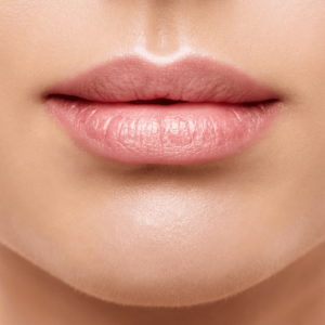 Read more about the article Smooth and Plump Lips with Lip Fillers