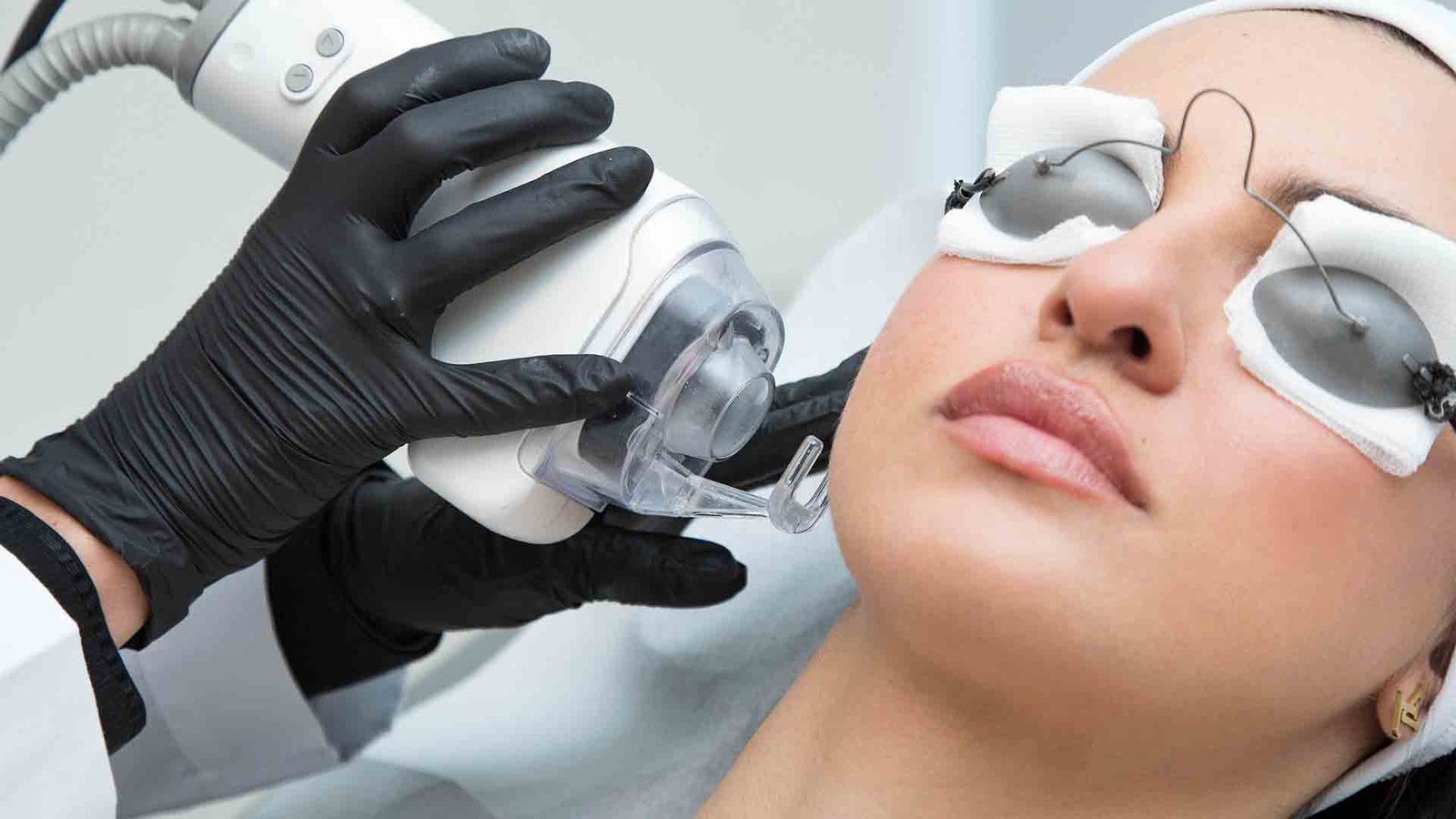 Read more about the article Personalized Fractional Laser Skin Treatments