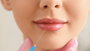 Read more about the article Russian Lip Fillers Focused on Shape and Height