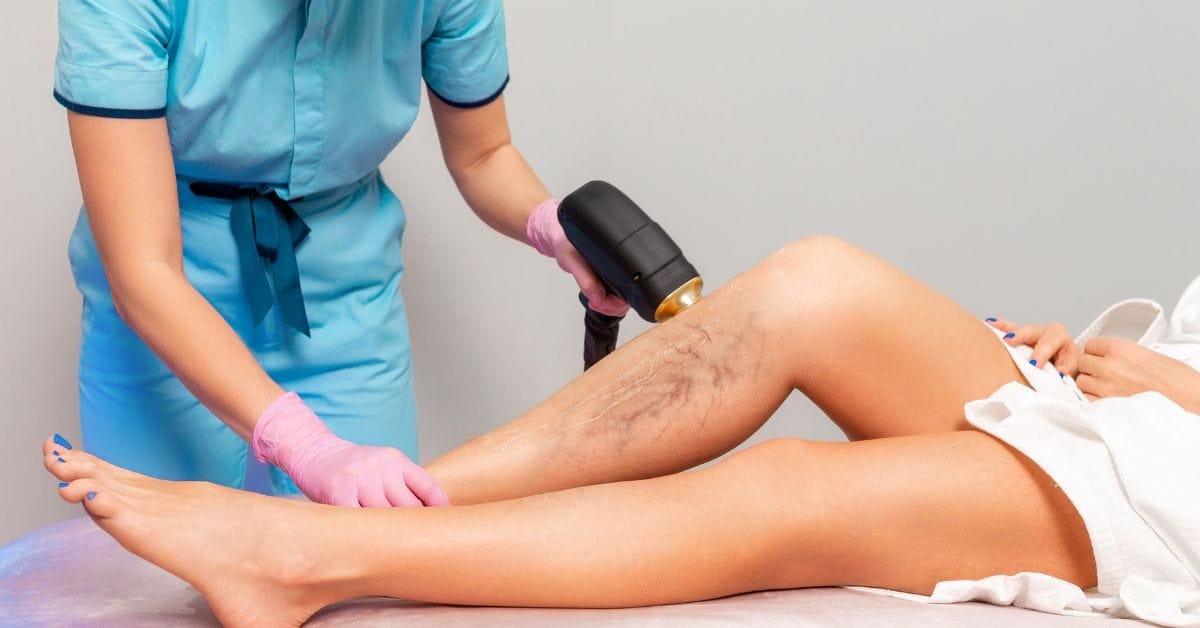 Read more about the article Treat Varicose Veins and Enhance Leg Appearance