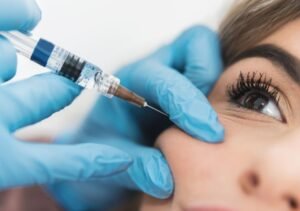 Read more about the article Under Eye Fillers Smooth Fine Lines and Shadows
