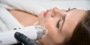 Read more about the article What Areas Can Be Treated Using RF Microneedling